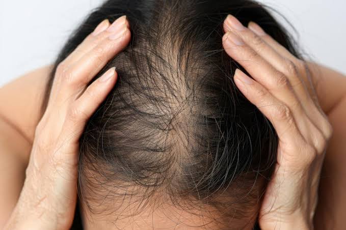 Sparse Hairline
