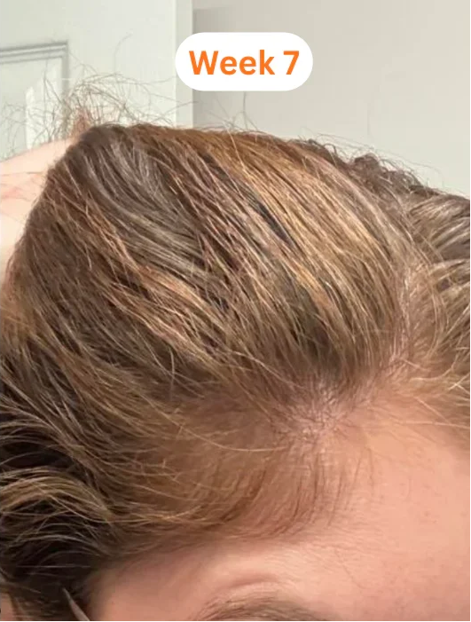 Medium Brown