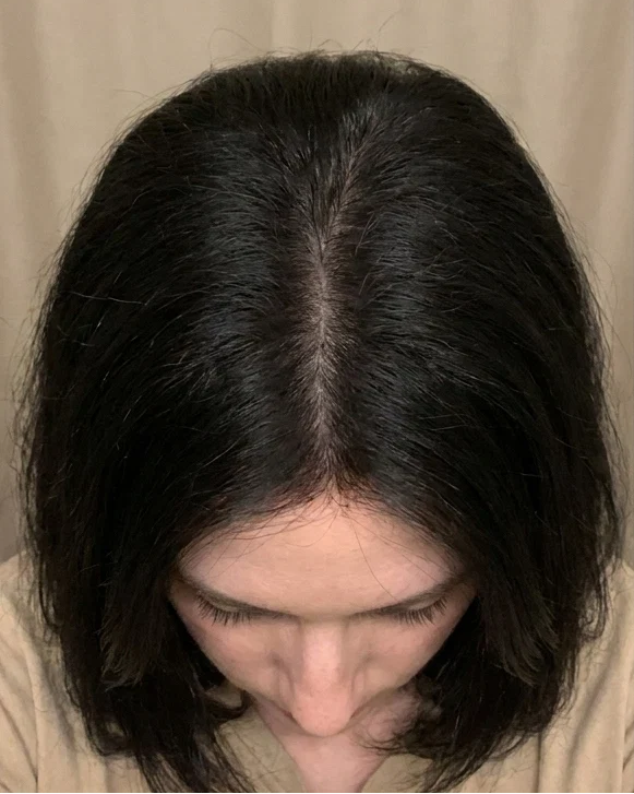 After