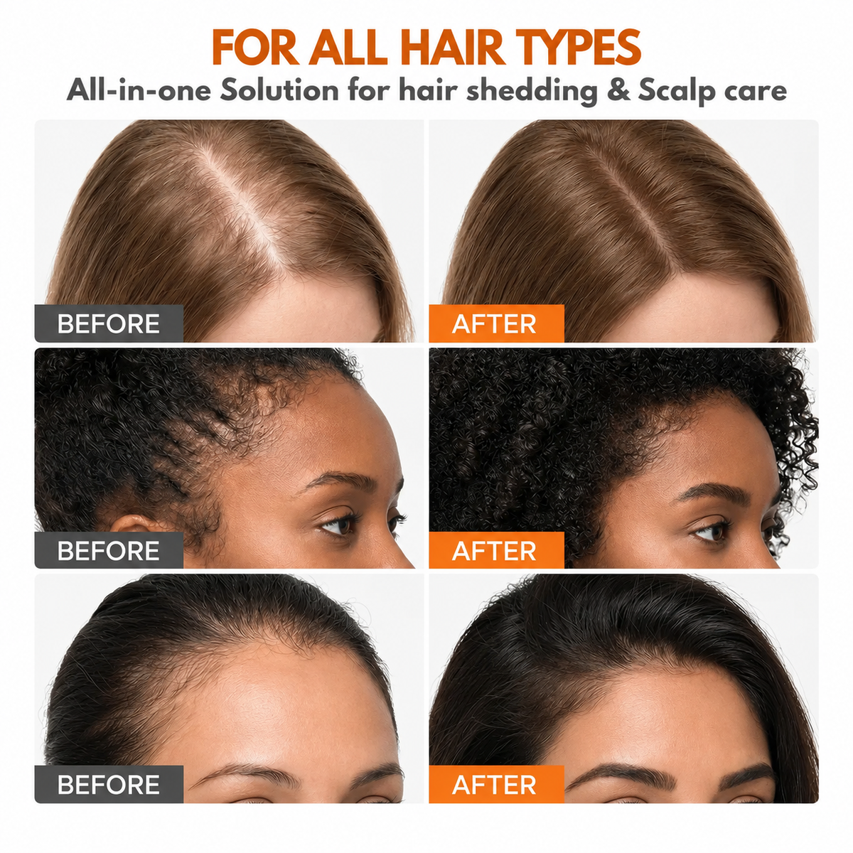 Korea's No.1 Hair Growth Serum