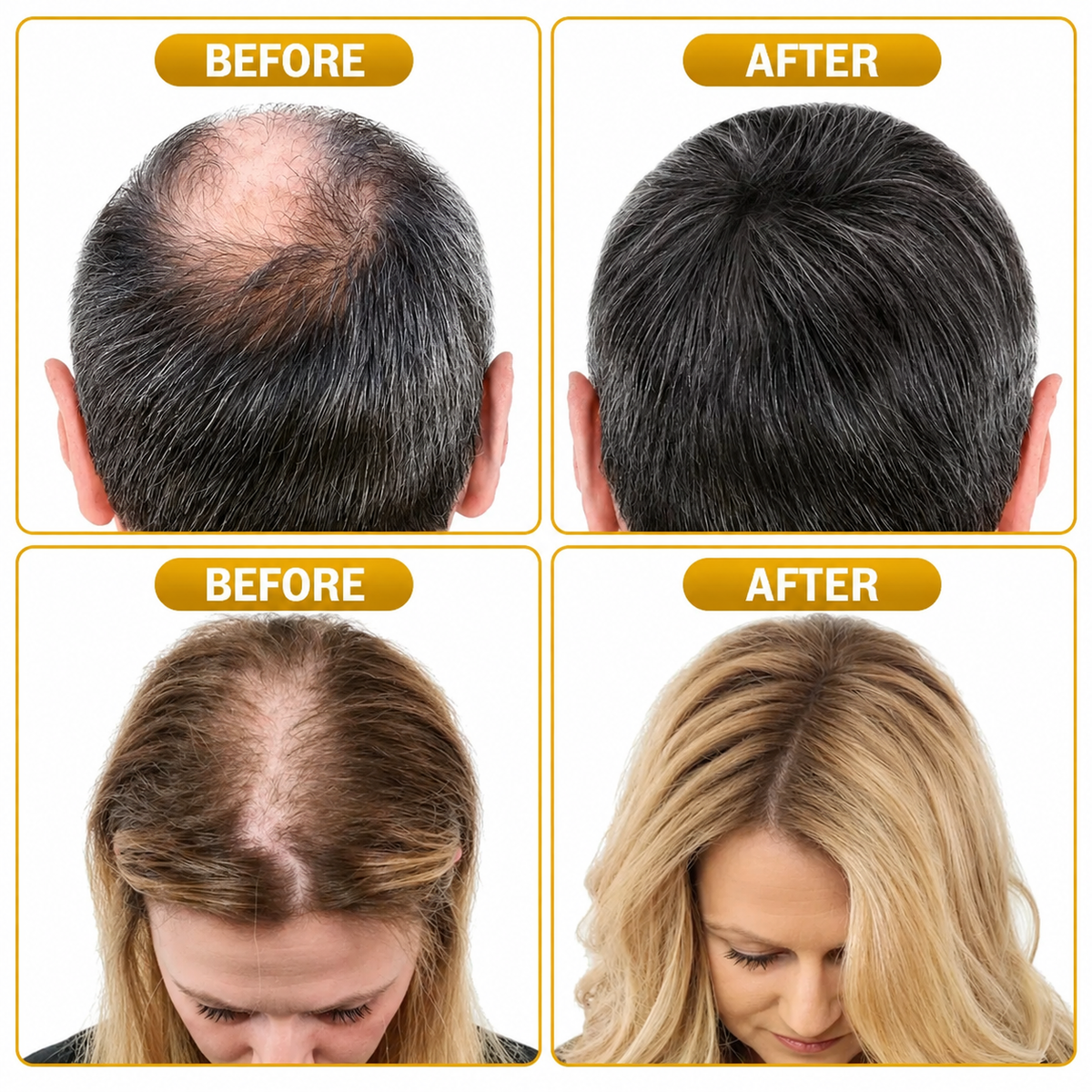 Hair Growth Serum Kit