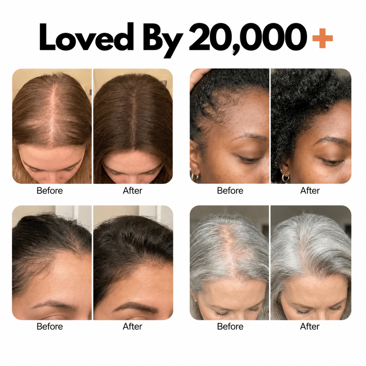 Korea's No.1 Hair Growth Serum