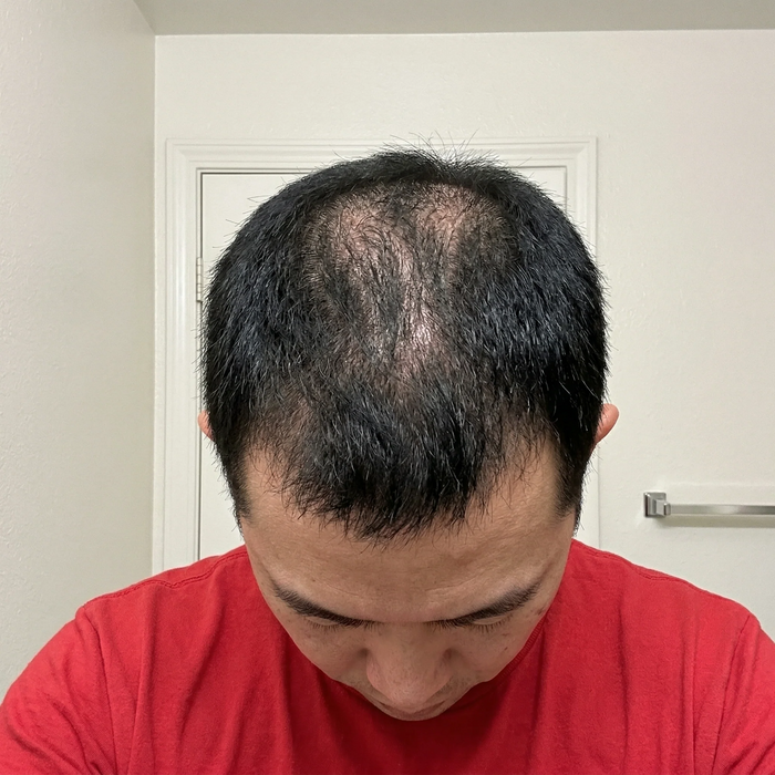 Before