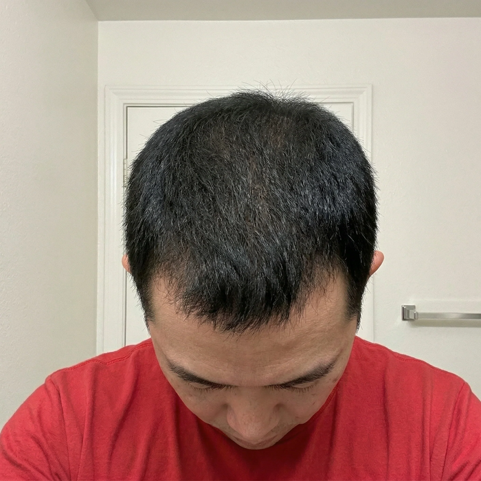 After