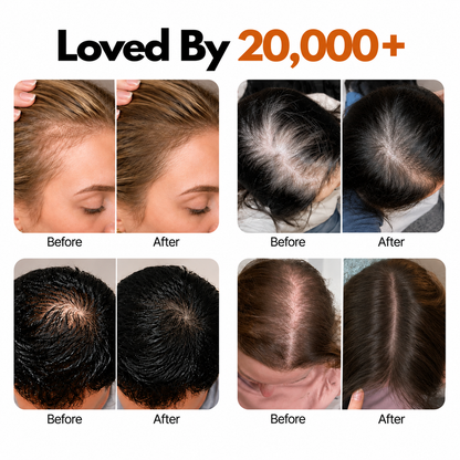 Korea’s No.1 Hair Growth Shampoo